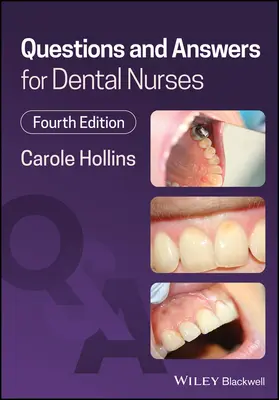 Otázky a odpovede pre zubné sestry - Questions and Answers for Dental Nurses