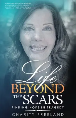 Život za hranicami jaziev: Nádej v tragédii - Life Beyond the Scars: Finding Hope in Tragedy