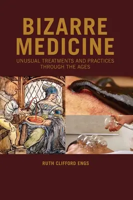 Bizarná medicína: Neobvyklé liečebné postupy a praktiky v priebehu vekov - Bizarre Medicine: Unusual Treatments and Practices through the Ages