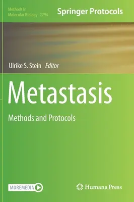 Metastázy: Metódy a protokoly - Metastasis: Methods and Protocols
