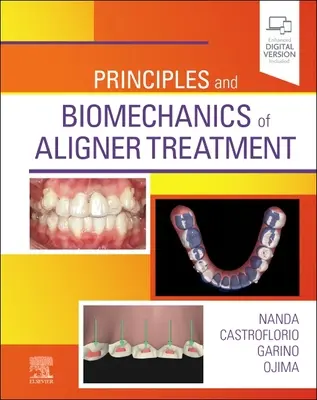 Princípy a biomechanika liečby vyrovnávaním - Principles and Biomechanics of Aligner Treatment