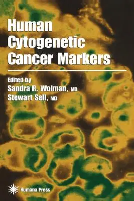 Ľudské cytogenetické markery rakoviny - Human Cytogenetic Cancer Markers
