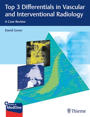 Top 3 diferenciály v cievnej a intervenčnej rádiológii: Prehľad prípadov - Top 3 Differentials in Vascular and Interventional Radiology: A Case Review