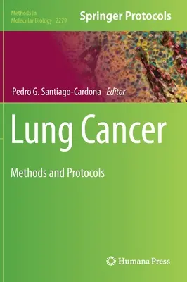 Rakovina pľúc: Metódy a protokoly - Lung Cancer: Methods and Protocols