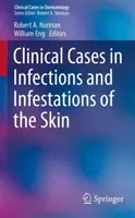 Klinické prípady infekcií a infekcií kože - Clinical Cases in Infections and Infestations of the Skin