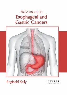Pokroky v oblasti rakoviny pažeráka a žalúdka - Advances in Esophageal and Gastric Cancers