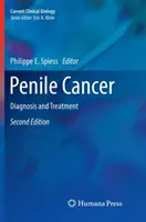 Rakovina penisu: Diagnostika a liečba - Penile Cancer: Diagnosis and Treatment