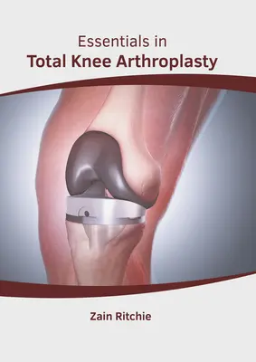 Základy totálnej artroplastiky kolena - Essentials in Total Knee Arthroplasty