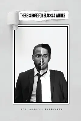 Existuje nádej pre čiernych a bielych - There Is Hope for Blacks & Whites