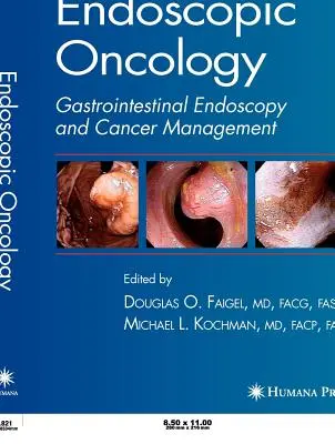 Endoskopická onkológia - Endoscopic Oncology