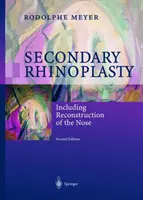 Sekundárna rinoplastika: Vrátane rekonštrukcie nosa - Secondary Rhinoplasty: Including Reconstruction of the Nose