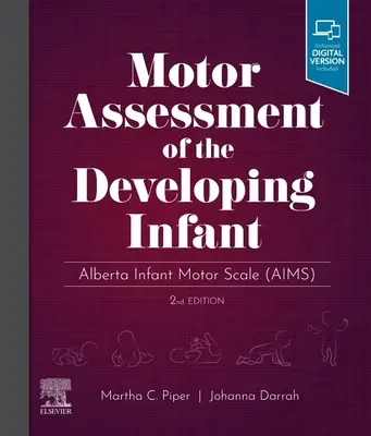 Motorické hodnotenie vyvíjajúceho sa dieťaťa - Alberta Infant Motor Scale - Motor Assessment of the Developing Infant - Alberta Infant Motor Scale