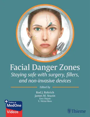 Nebezpečné zóny tváre: Zostaňte v bezpečí pri operáciách, výplňových materiáloch a neinvazívnych prístrojoch - Facial Danger Zones: Staying Safe with Surgery, Fillers, and Non-Invasive Devices