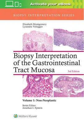 Interpretácia biopsie sliznice gastrointestinálneho traktu: 1. zväzok: Neoplastické - Biopsy Interpretation of the Gastrointestinal Tract Mucosa: Volume 1: Non-Neoplastic