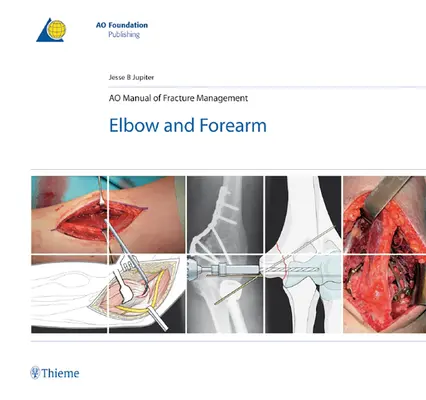 Ao Príručka liečby zlomenín - lakeť a predlaktie - Ao Manual of Fracture Management - Elbow & Forearm