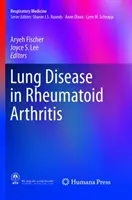 Ochorenie pľúc pri reumatoidnej artritíde - Lung Disease in Rheumatoid Arthritis