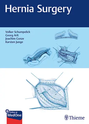 Chirurgia prietrže - Hernia Surgery