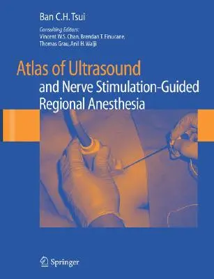 Atlas ultrazvuku a regionálnej anestézie riadenej nervovou stimuláciou - Atlas of Ultrasound and Nerve Stimulation-Guided Regional Anesthesia