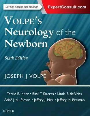 Volpeho neurológia novorodenca - Volpe's Neurology of the Newborn