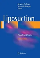 Liposukcia: Princípy a prax - Liposuction: Principles and Practice