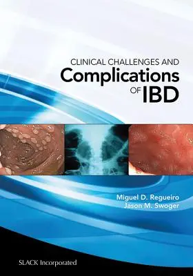 Klinické výzvy a komplikácie Ibd - Clinical Challenges and Complications of Ibd