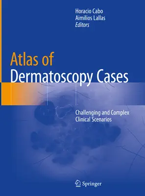 Atlas dermatoskopických prípadov: Náročné a komplexné klinické scenáre - Atlas of Dermatoscopy Cases: Challenging and Complex Clinical Scenarios