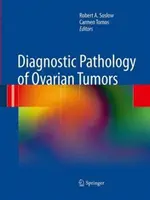 Diagnostická patológia nádorov vaječníkov - Diagnostic Pathology of Ovarian Tumors