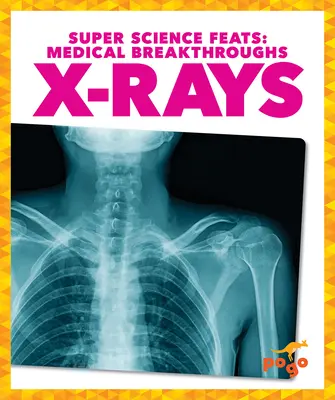 Röntgenové žiarenie - X-Rays