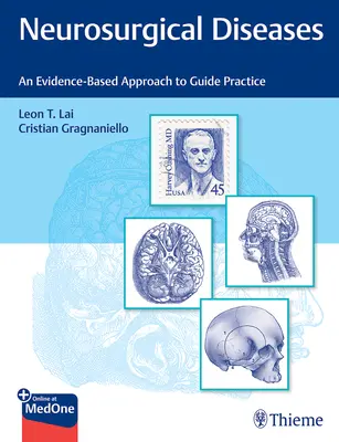 Neurochirurgické ochorenia: Prístup založený na dôkazoch na usmernenie praxe - Neurosurgical Diseases: An Evidence-Based Approach to Guide Practice