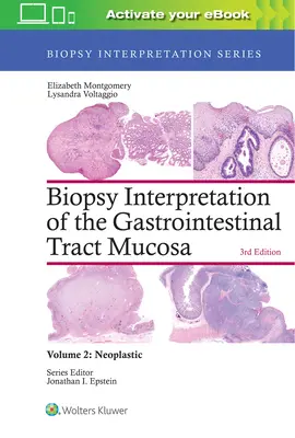Interpretácia biopsie sliznice gastrointestinálneho traktu: 2. diel: Neoplastické - Biopsy Interpretation of the Gastrointestinal Tract Mucosa: Volume 2: Neoplastic