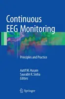 Kontinuálne Eeg monitorovanie: Princípy a prax - Continuous Eeg Monitoring: Principles and Practice