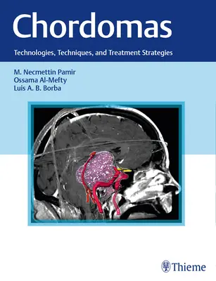 Chordómy: Technológie, techniky a stratégie liečby - Chordomas: Technologies, Techniques, and Treatment Strategies