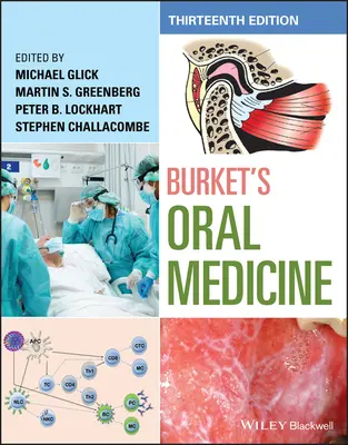 Burketova ústna medicína - Burket's Oral Medicine