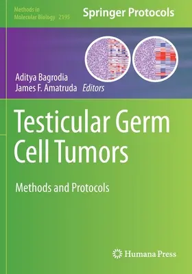 Testikulárne zárodočné nádory: Metódy a protokoly - Testicular Germ Cell Tumors: Methods and Protocols