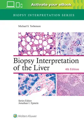 Interpretácia biopsie pečene - Biopsy Interpretation of the Liver