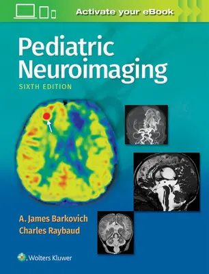 Pediatrické neurozobrazovanie - Pediatric Neuroimaging