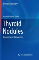 Uzly štítnej žľazy: Diagnostika a manažment - Thyroid Nodules: Diagnosis and Management