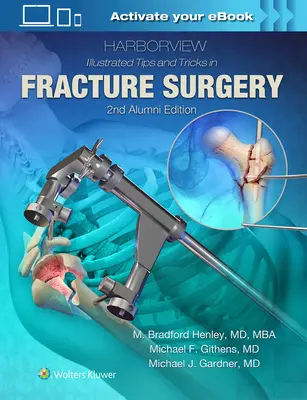 Harborview Ilustrované tipy a triky pri operácii zlomenín - Harborview Illustrated Tips and Tricks in Fracture Surgery