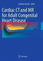 CT a MR srdca pri vrodených srdcových chybách dospelých - Cardiac CT and MR for Adult Congenital Heart Disease