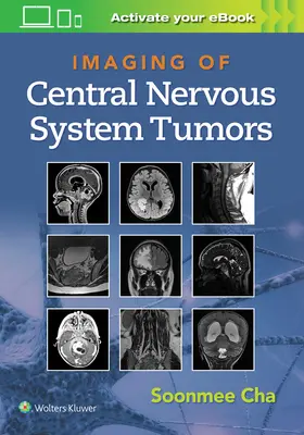 Zobrazovanie nádorov centrálneho nervového systému - Imaging of Central Nervous System Tumors
