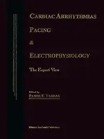 Srdcové arytmie, kardiostimulácia a elektrofyziológia: Pohľad experta - Cardiac Arrhythmias, Pacing & Electrophysiology: The Expert View