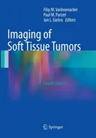 Zobrazovanie nádorov mäkkých tkanív - Imaging of Soft Tissue Tumors