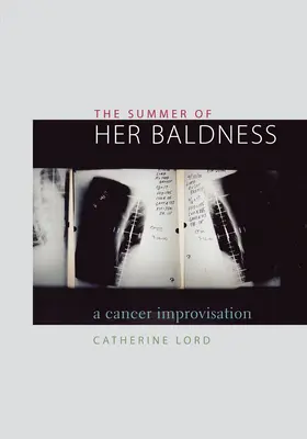 Leto jej plešatosti: Improvizácia o rakovine - The Summer of Her Baldness: A Cancer Improvisation