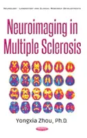 Neurozobrazovanie pri skleróze multiplex - Neuroimaging in Multiple Sclerosis