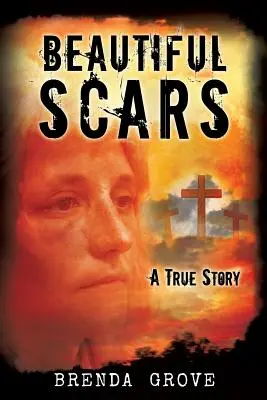 Krásne jazvy - Beautiful Scars