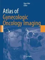 Atlas gynekologického onkologického zobrazovania - Atlas of Gynecologic Oncology Imaging