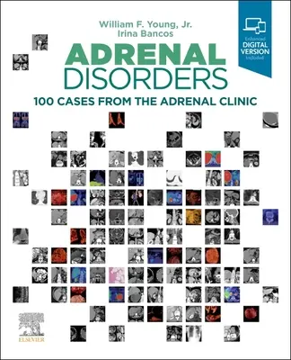 Poruchy nadobličiek: 100 prípadov z adrenálnej kliniky - Adrenal Disorders: 100 Cases from the Adrenal Clinic