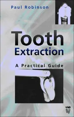 Extrakcia zubov: Praktická príručka - Tooth Extraction: A Practical Guide