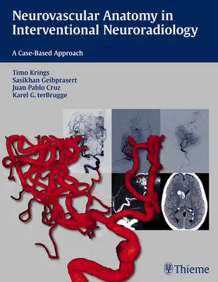 Neurovaskulárna anatómia v intervenčnej neurorádiológii: Prístup založený na konkrétnych prípadoch - Neurovascular Anatomy in Interventional Neuroradiology: A Case-Based Approach