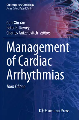 Manažment srdcových arytmií - Management of Cardiac Arrhythmias